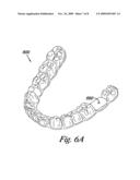 Dental implant positioning diagram and image