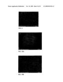 FIBROUS CALCIUM PYROPHOSPHATE PARTICLES AND METHODS OF MAKING AND USING SAME diagram and image