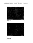 FIBROUS CALCIUM PYROPHOSPHATE PARTICLES AND METHODS OF MAKING AND USING SAME diagram and image