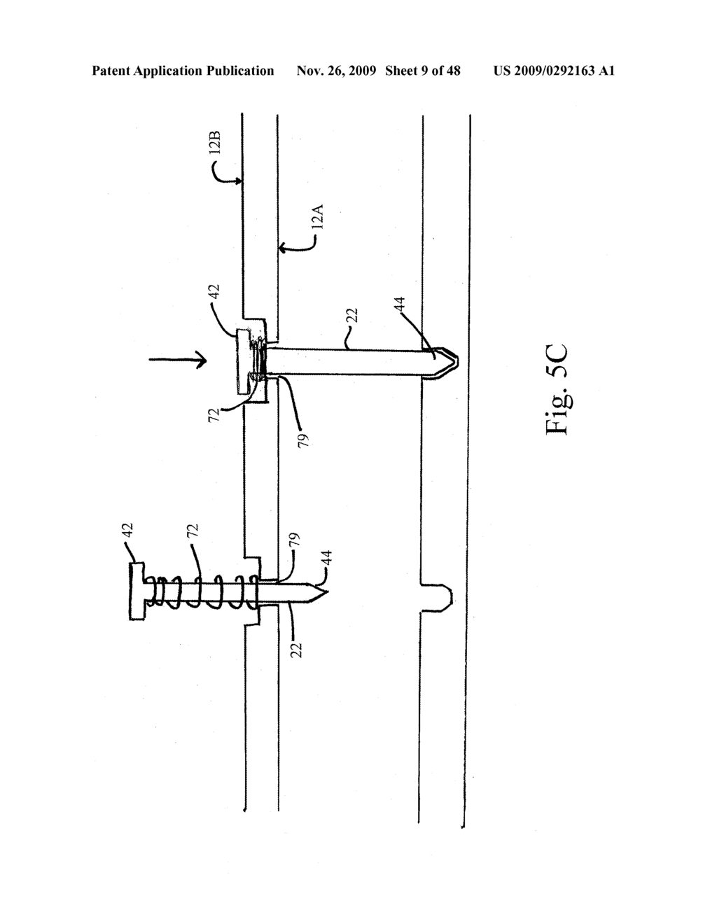 DEVICES AND METHODS FOR ACHIEVING THE LAPAROSCOPIC DELIVERY OF A DEVICE - diagram, schematic, and image 10