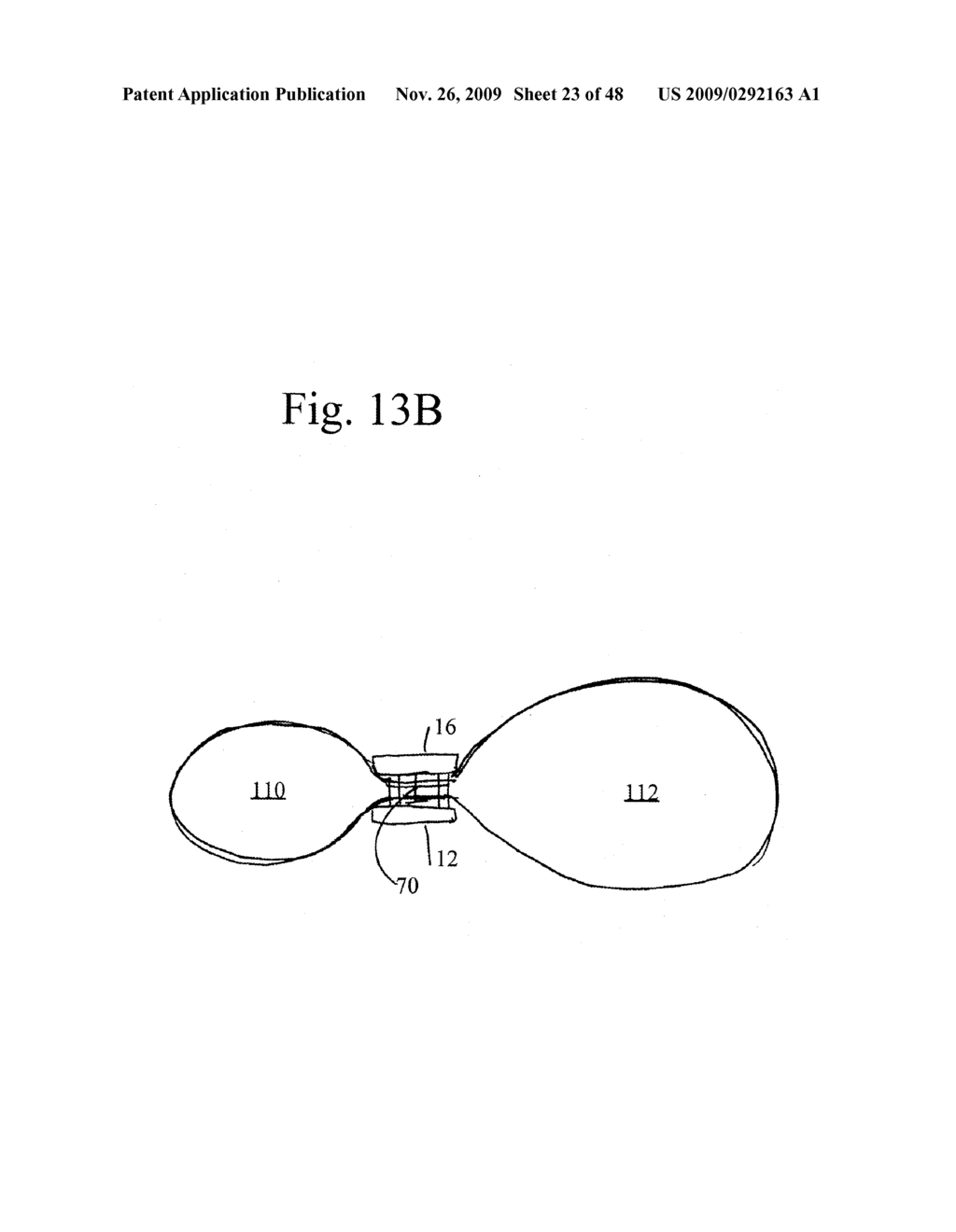 DEVICES AND METHODS FOR ACHIEVING THE LAPAROSCOPIC DELIVERY OF A DEVICE - diagram, schematic, and image 24