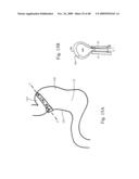 DEVICES AND METHODS FOR ACHIEVING THE LAPAROSCOPIC DELIVERY OF A DEVICE diagram and image