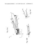 DEVICES AND METHODS FOR ACHIEVING THE LAPAROSCOPIC DELIVERY OF A DEVICE diagram and image