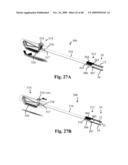 DEVICES AND METHODS FOR ACHIEVING THE LAPAROSCOPIC DELIVERY OF A DEVICE diagram and image