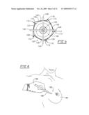 Method and apparatus for positioning a tissue recovery instrument in confronting adjacency with a target tissue volume diagram and image