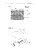 Method and apparatus for positioning a tissue recovery instrument in confronting adjacency with a target tissue volume diagram and image