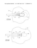 Method and apparatus for positioning a tissue recovery instrument in confronting adjacency with a target tissue volume diagram and image