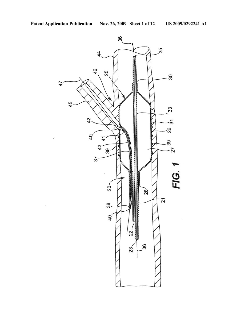 BALLOON CATHETER - diagram, schematic, and image 02