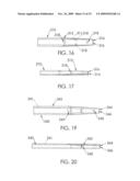 Method for Inserting a Catheter diagram and image