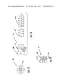 GUIDE ASSEMBLY FOR INTRAMEDULLARY FIXATION AND METHOD OF USING THE SAME diagram and image