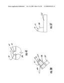 GUIDE ASSEMBLY FOR INTRAMEDULLARY FIXATION AND METHOD OF USING THE SAME diagram and image