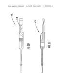 GUIDE ASSEMBLY FOR INTRAMEDULLARY FIXATION AND METHOD OF USING THE SAME diagram and image