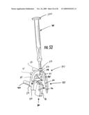 GUIDE ASSEMBLY FOR INTRAMEDULLARY FIXATION AND METHOD OF USING THE SAME diagram and image