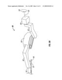 OFFSET REMOTE CENTER MANIPULATOR FOR ROBOTIC SURGERY diagram and image