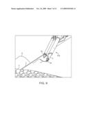 Suturing Device, System, and Method diagram and image