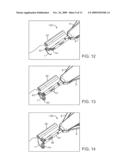 Suturing Device, System, and Method diagram and image