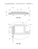 IMPLANTABLE MEDICAL DEVICE WITH ANTI-INFECTION AGENT diagram and image