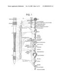 ELECTRICAL STIMULATION TREATMENT OF HYPOTENSION diagram and image
