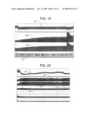 ELECTRICAL STIMULATION TREATMENT OF HYPOTENSION diagram and image