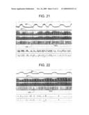 ELECTRICAL STIMULATION TREATMENT OF HYPOTENSION diagram and image