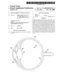 REDUCED PROFILE INTRAOCULAR LENS diagram and image