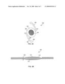 REDUCED PROFILE INTRAOCULAR LENS diagram and image