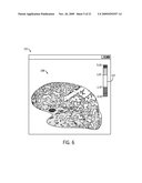 System and Method for Disease Diagnosis from Patient Structural Deviation Data diagram and image