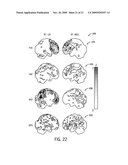 System and Method for Disease Diagnosis from Patient Structural Deviation Data diagram and image