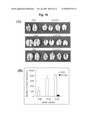 ANIMAL MODELS CARRYING TUMORS EXPRESSING HUMAN PROSTATE CANCER-SPECIFIC ANTIGEN AND METHOD FOR ANALYZING PREVENTION AND TREATMENT EFFICACY OF DENDRITIC CELLS-DERIVED IMMUNOTHERAPEUTICS diagram and image