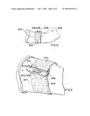 BELT OR BAND-LIKE EXERCISE RESULT MEASUREMENT ARTICLE WITH SELECTABLE DISPLAY ASPECT diagram and image