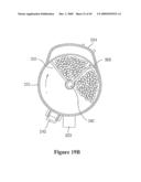 VACUUM CLEANER WITH REMOVABLE DUST COLLECTOR, AND METHODS OF OPERATNG THE SAME diagram and image