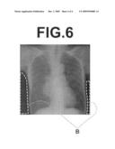 Radiation image correction apparatus, method, and program diagram and image