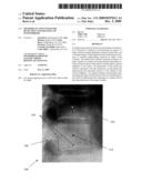 Methods of and System for Detection and Tracking of Osteoporosis diagram and image