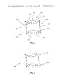 Methods of and System for Detection and Tracking of Osteoporosis diagram and image