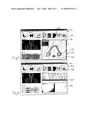 SYSTEM FOR ASSESSING RADIATION TREATMENT PLAN SEGMENTATIONS diagram and image