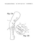 Wearable Wound Simulant diagram and image