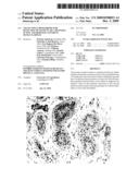 Use of novel biomarkers for detection of testicular carcinoma in situ and derived cancers in human samples diagram and image