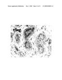 Use of novel biomarkers for detection of testicular carcinoma in situ and derived cancers in human samples diagram and image