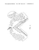 Radioactive therapeutic apparatus diagram and image