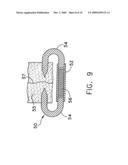 Radioactive therapeutic apparatus diagram and image