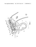 Laparoscopic Surgical Instrument diagram and image