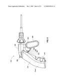 Laparoscopic Surgical Instrument diagram and image