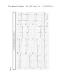 MOBILE- AND WEB-BASED 12-LEAD ECG MANAGEMENT diagram and image