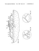 SEE-THROUGH, REDUCED-PRESSURE DRESSINGS AND SYSTEMS diagram and image