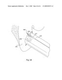 Surgical bone cutting assembly and method of using same diagram and image