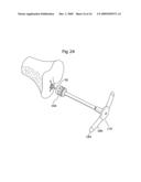 Surgical bone cutting assembly and method of using same diagram and image