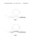 DEVICE AND METHODS FOR NON-SURGICAL CLIPPING OF ANEURYSMS diagram and image