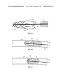 RETRIEVAL SYSTEMS AND METHODS FOR USE THEREOF diagram and image