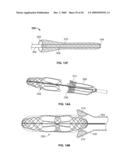 RETRIEVAL SYSTEMS AND METHODS FOR USE THEREOF diagram and image