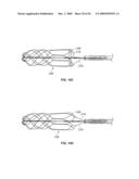 RETRIEVAL SYSTEMS AND METHODS FOR USE THEREOF diagram and image